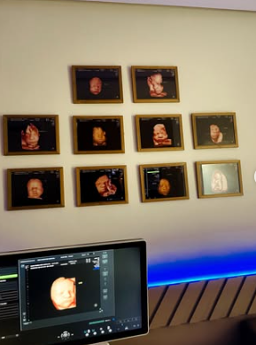 Sala de ultrassonografia da Clínica AMA
